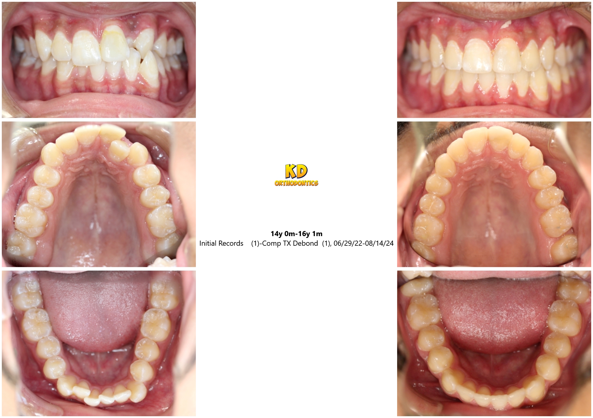 Orthodontic Treatment Options - KD Orthodontics - Chandler AZ